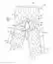 Fig. 01 - Stent-graft having supported transition stent and method