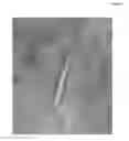 Fig. 06 - Methods of treating a musculoskeletal tissue interface injury using decellularized composite tissue bioscaffolds