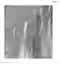 Fig. 07 - Methods of treating a musculoskeletal tissue interface injury using decellularized composite tissue bioscaffolds