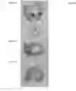 Fig. 08 - Methods of treating a musculoskeletal tissue interface injury using decellularized composite tissue bioscaffolds