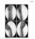 Fig. 09 - Methods of treating a musculoskeletal tissue interface injury using decellularized composite tissue bioscaffolds