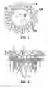 Fig. 03 - Device and method for mitral valve regurgitation treatment
