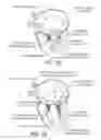 Fig. 03 - Multiple Aperture Sling for Mitral Heart Valves
