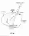 Fig. 08 - Multiple Aperture Sling for Mitral Heart Valves