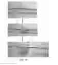 Fig. 03 - Retrievable self-expanding non-thrombogenic low-profile percutaneous atrioventricular valve prosthesis