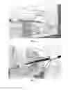 Fig. 04 - Retrievable self-expanding non-thrombogenic low-profile percutaneous atrioventricular valve prosthesis