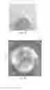 Fig. 08 - Retrievable self-expanding non-thrombogenic low-profile percutaneous atrioventricular valve prosthesis