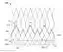 Fig. 01 - Prosthetic heart valve with paravalvular leak mitigation features