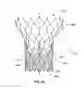 Fig. 06 - Stent cell bridge for cuff attachment