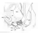 Fig. 01 - Apparatuses and methods for at least partially supporting a valve leaflet of a regurgitant heart valve