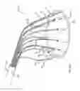 Fig. 09 - Multi-channel apparatus for delivering a constricting cord or a ring to a cardiac valve annulus