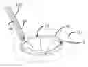 Fig. 01 - Preventing tissue ingrowth into constricting cords after implantation