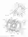 Fig. 05 - Preventing tissue ingrowth into constricting cords after implantation