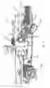 Fig. 08 - Preventing tissue ingrowth into constricting cords after implantation