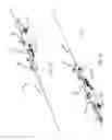 Fig. 02 - Delivering a constricting cord to a cardiac valve annulus using balloon-assisted positioning