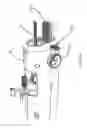 Fig. 07 - Delivering a constricting cord to a cardiac valve annulus using balloon-assisted positioning