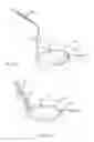 Fig. 20 - Preventing dislodgement of a constricting cord that has been affixed to a cardiac valve annulus