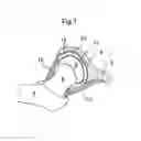 Fig. 02 - Hip joint device