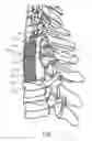 Fig. 02 - Center lordotic mesh cage