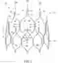 Fig. 02 - Stent designs for use with one or more trigger wires