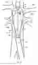 Fig. 10 - Fenestrated endoluminal prosthesis and system and method of deployment thereof