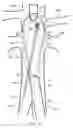 Fig. 12 - Fenestrated endoluminal prosthesis and system and method of deployment thereof