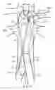 Fig. 13 - Fenestrated endoluminal prosthesis and system and method of deployment thereof
