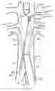 Fig. 15 - Fenestrated endoluminal prosthesis and system and method of deployment thereof