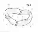 Fig. 02 - Incremental and/or successive adjustable mandibular advancement device for preventing and treatment of snoring and obstructive sleep apnea