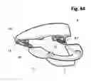 Fig. 45 - Incremental and/or successive adjustable mandibular advancement device for preventing and treatment of snoring and obstructive sleep apnea
