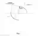 Fig. 02 - Laser system and method for astigmatic corrections in association with cataract treatment