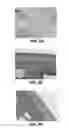 Fig. 07 - INJECTABLE SUSTAINED RELEASE COMPOSITION AND METHOD OF USING THE SAME FOR TREATING INFLAMMATION IN JOINTS AND PAIN ASSOCIATED THEREWITH