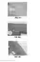 Fig. 07 - INJECTABLE SUSTAINED RELEASE COMPOSITION AND METHOD OF USING THE SAME FOR TREATING INFLAMMATION IN JOINTS AND PAIN ASSOCIATED THEREWITH