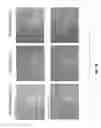 Fig. 07 - Compositions and Methods for Traumatized Tissues Using Zinc Chelators