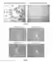 Fig. 08 - Compositions and Methods for Traumatized Tissues Using Zinc Chelators
