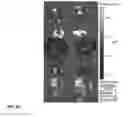 Fig. 06 - Cholecystokinin 2 receptor targeted NIR imaging and use thereof