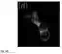 Fig. 28 - Cholecystokinin 2 receptor targeted NIR imaging and use thereof