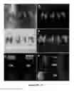 Fig. 03 - Photoluminescent hydrogel