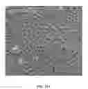 Fig. 33 - Bone graft with a tannin-hydroxyapatite scaffold and stem cells for bone engineering