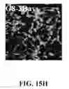 Fig. 63 - Bone graft with a tannin-hydroxyapatite scaffold and stem cells for bone engineering
