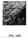 Fig. 69 - Bone graft with a tannin-hydroxyapatite scaffold and stem cells for bone engineering