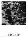 Fig. 71 - Bone graft with a tannin-hydroxyapatite scaffold and stem cells for bone engineering