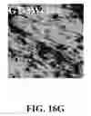 Fig. 72 - Bone graft with a tannin-hydroxyapatite scaffold and stem cells for bone engineering