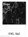 Fig. 75 - Bone graft with a tannin-hydroxyapatite scaffold and stem cells for bone engineering
