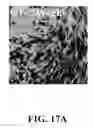 Fig. 76 - Bone graft with a tannin-hydroxyapatite scaffold and stem cells for bone engineering