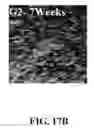 Fig. 77 - Bone graft with a tannin-hydroxyapatite scaffold and stem cells for bone engineering
