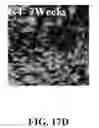 Fig. 79 - Bone graft with a tannin-hydroxyapatite scaffold and stem cells for bone engineering
