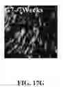 Fig. 82 - Bone graft with a tannin-hydroxyapatite scaffold and stem cells for bone engineering