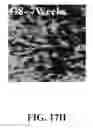 Fig. 83 - Bone graft with a tannin-hydroxyapatite scaffold and stem cells for bone engineering