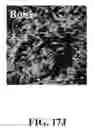 Fig. 85 - Bone graft with a tannin-hydroxyapatite scaffold and stem cells for bone engineering